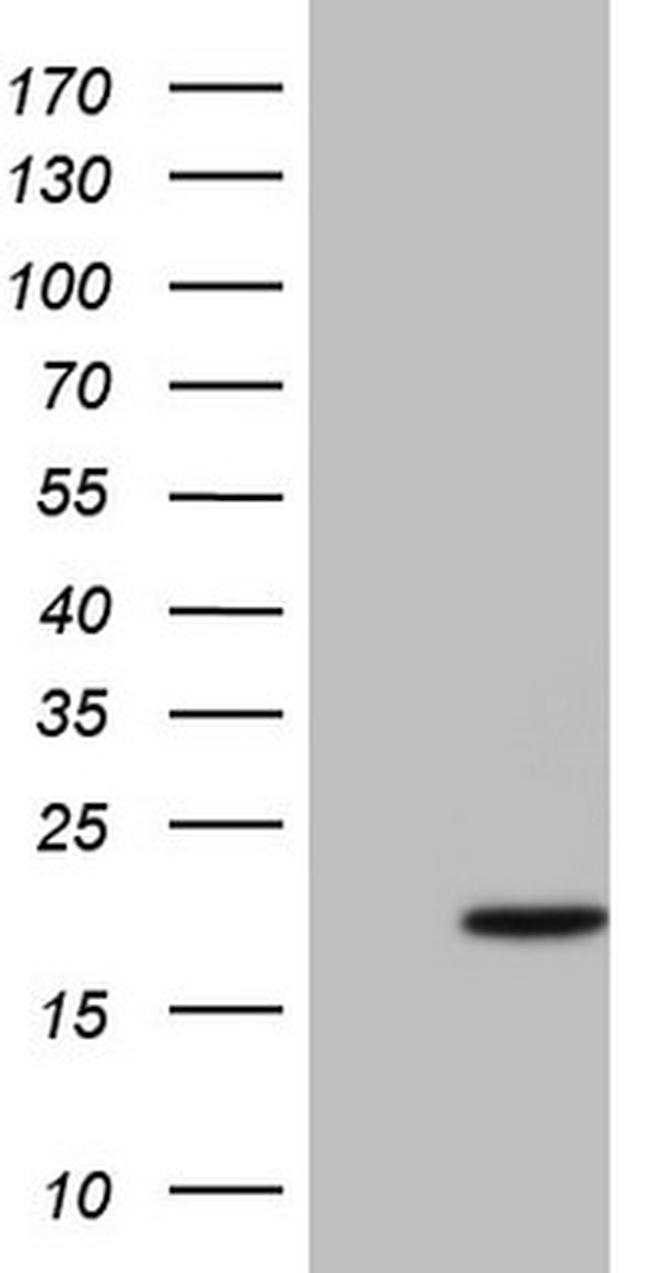 CDKN2A (p16INK4a) Antibody in Western Blot (WB)