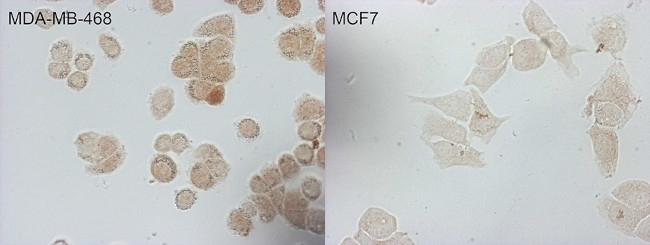 CDKN2A (p16INK4a) Antibody in Immunocytochemistry (ICC/IF)