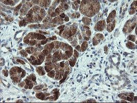 CDKN2B Antibody in Immunohistochemistry (Paraffin) (IHC (P))