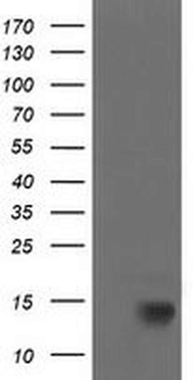 CDKN2B Antibody in Western Blot (WB)