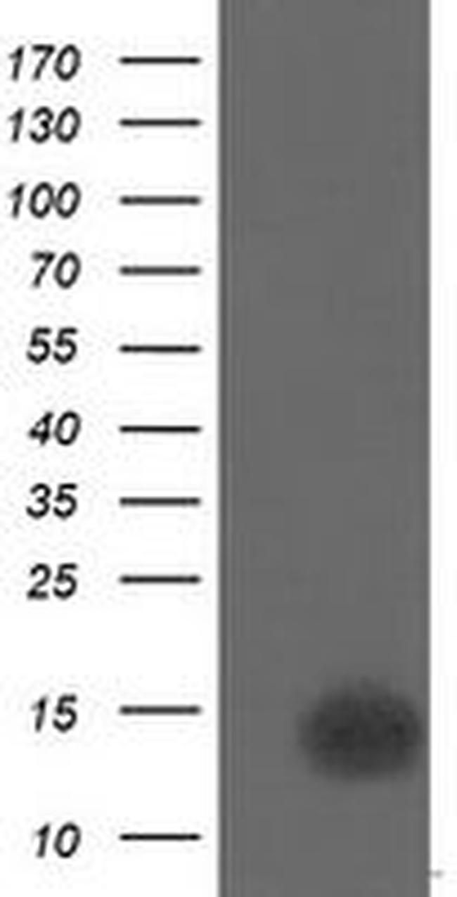 CDKN2B Antibody in Western Blot (WB)