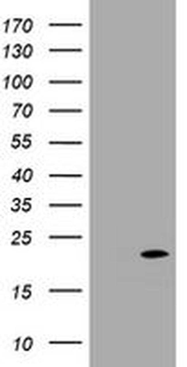 CDKN2C Antibody in Western Blot (WB)