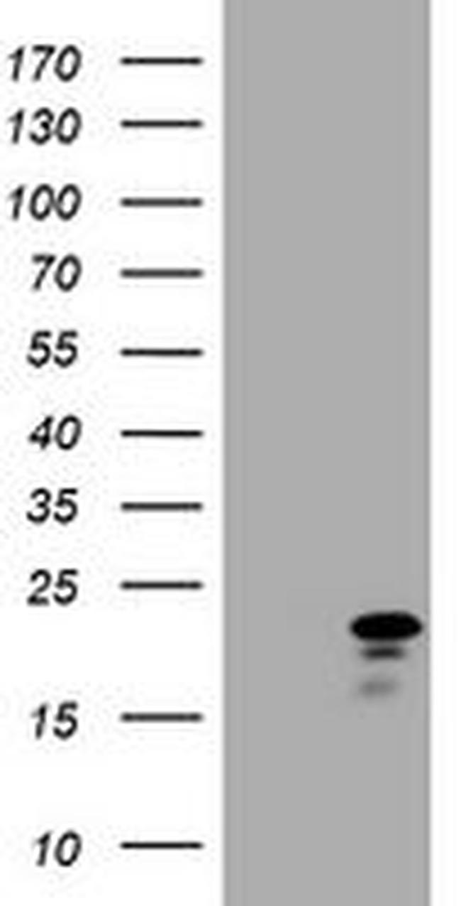 CDKN2C Antibody in Western Blot (WB)