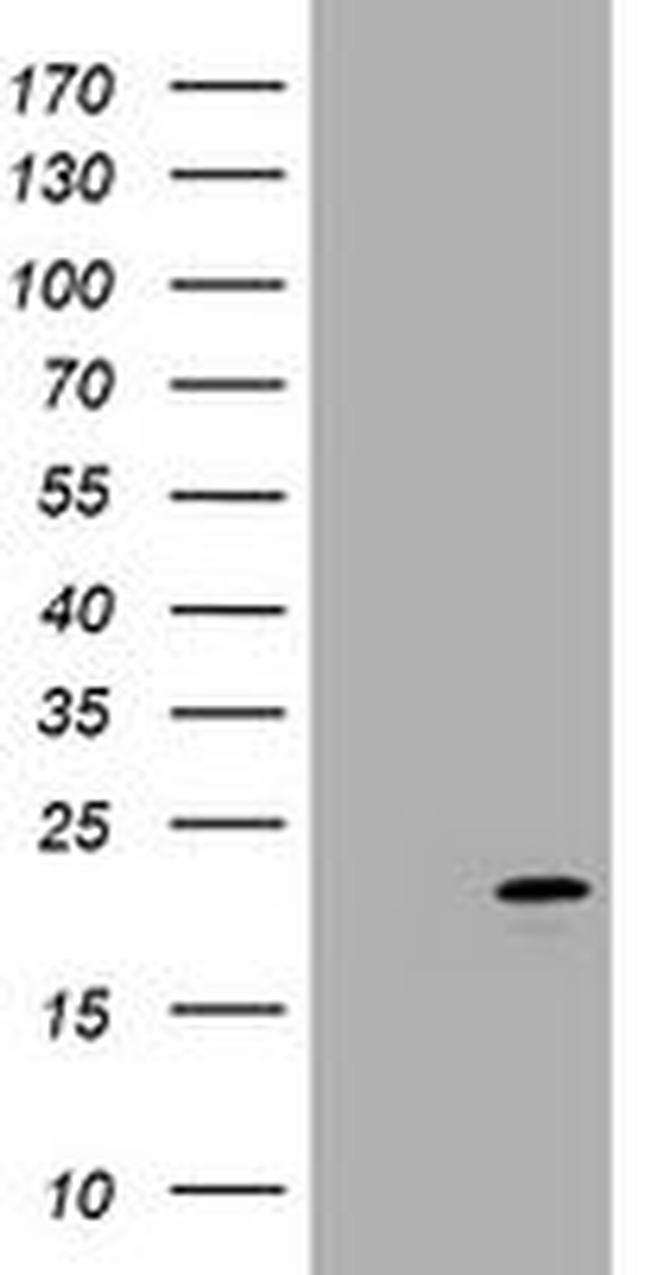 CDKN2C Antibody in Western Blot (WB)