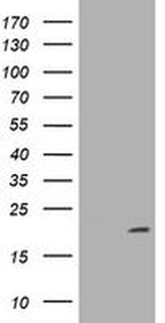 CDKN2C Antibody in Western Blot (WB)