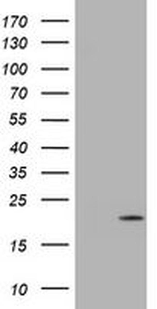 CDKN2C Antibody in Western Blot (WB)
