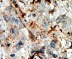 CDKN3 Antibody in Immunohistochemistry (IHC)