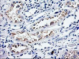 CDKN3 Antibody in Immunohistochemistry (Paraffin) (IHC (P))