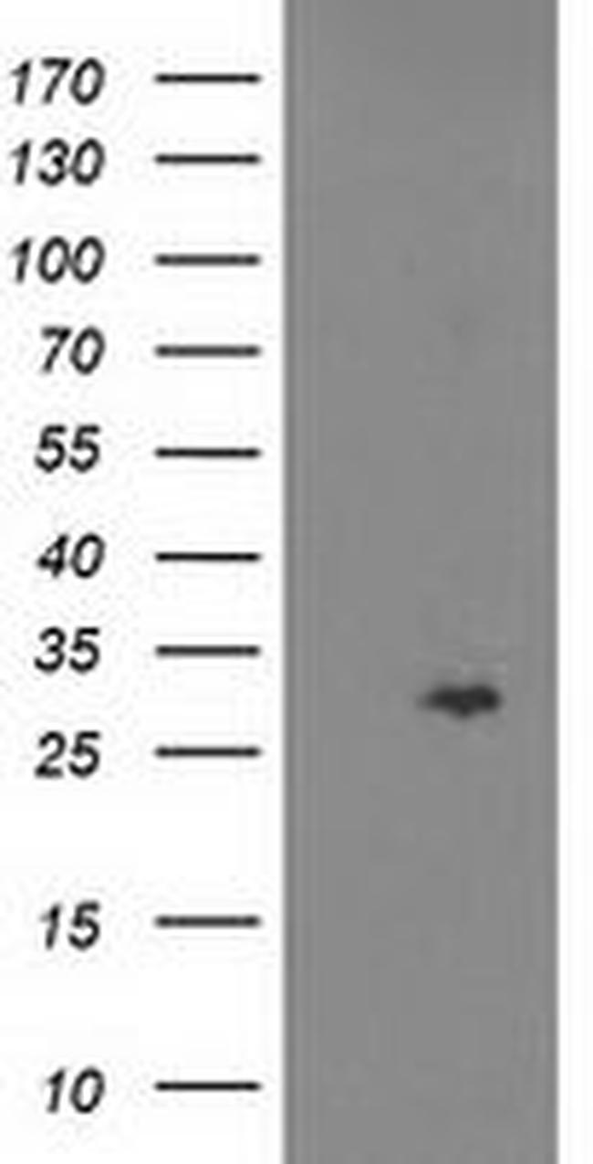 CDKN3 Antibody in Western Blot (WB)
