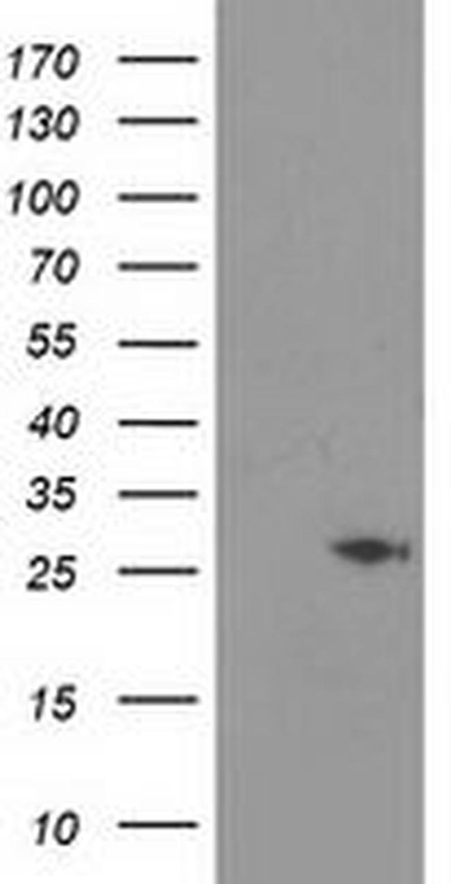 CDKN3 Antibody in Western Blot (WB)