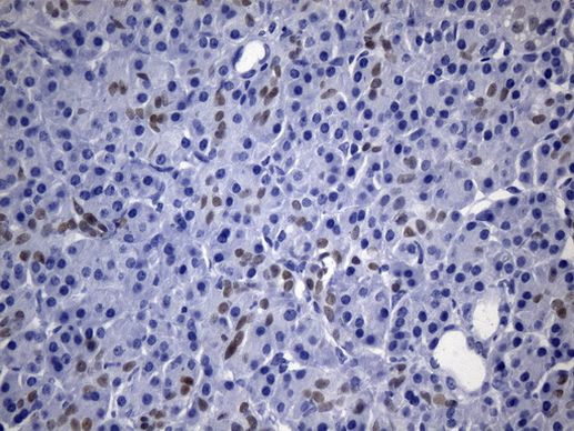CDX2 Antibody in Immunohistochemistry (Paraffin) (IHC (P))