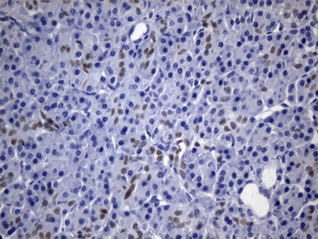 CDX2 Antibody in Immunohistochemistry (Paraffin) (IHC (P))