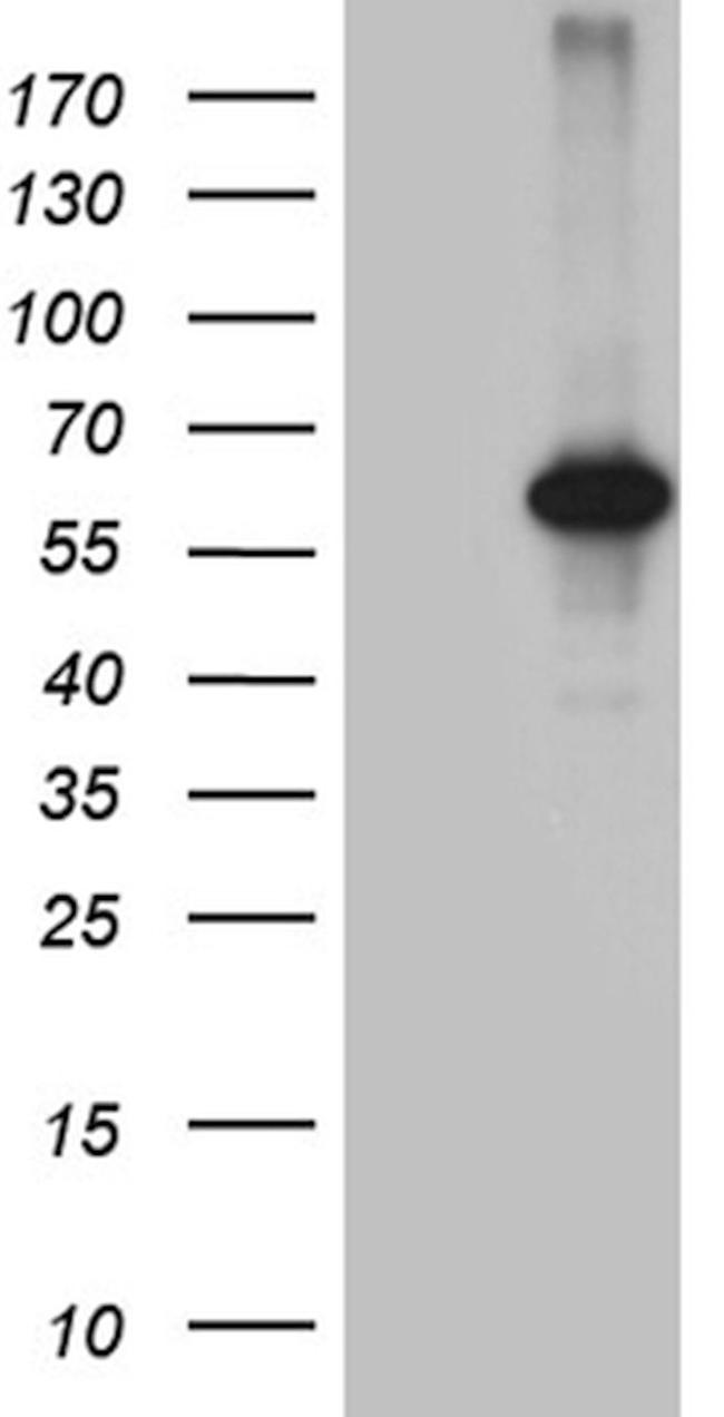 CDY2B Antibody in Western Blot (WB)