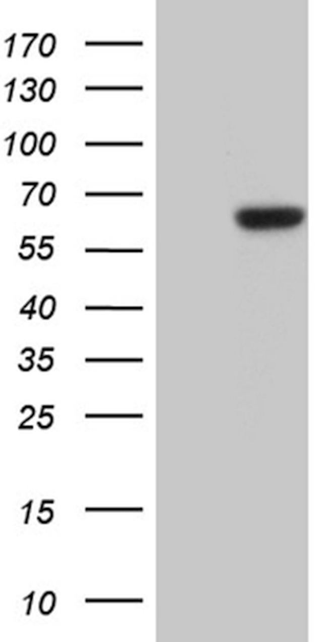 CDY2B Antibody in Western Blot (WB)