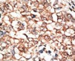CDw293 Antibody in Immunohistochemistry (IHC)