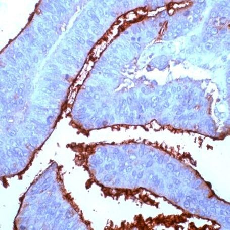 CEA Antibody in Immunohistochemistry (IHC)