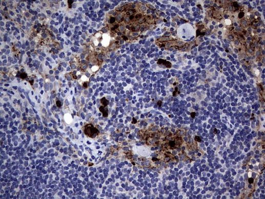 CEA (CEACAM5) Antibody in Immunohistochemistry (Paraffin) (IHC (P))