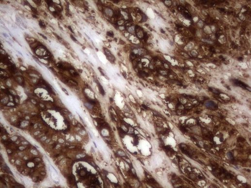CEA (CEACAM5) Antibody in Immunohistochemistry (Paraffin) (IHC (P))
