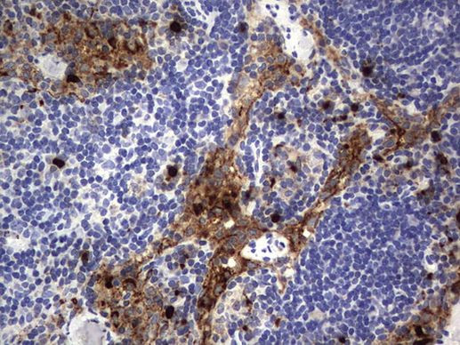 CEA (CEACAM5) Antibody in Immunohistochemistry (Paraffin) (IHC (P))