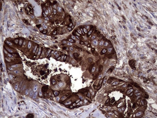 CEACAM6 Antibody in Immunohistochemistry (Paraffin) (IHC (P))