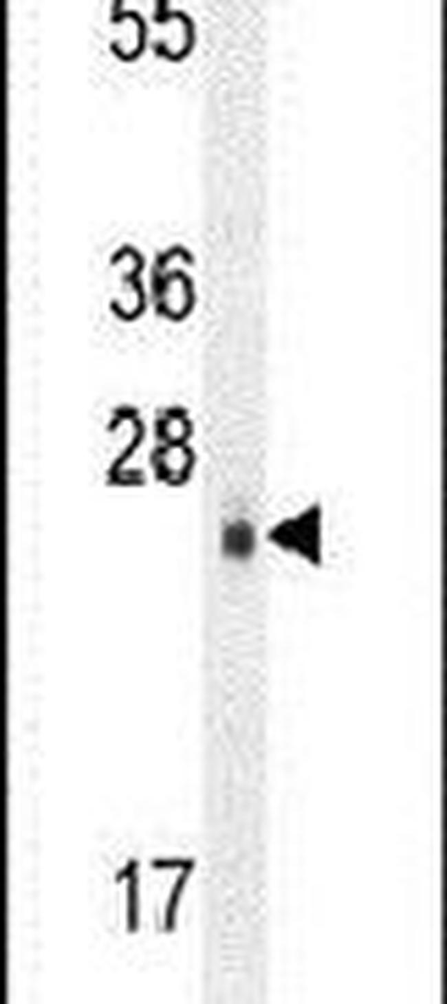 C/EBP delta Antibody in Western Blot (WB)