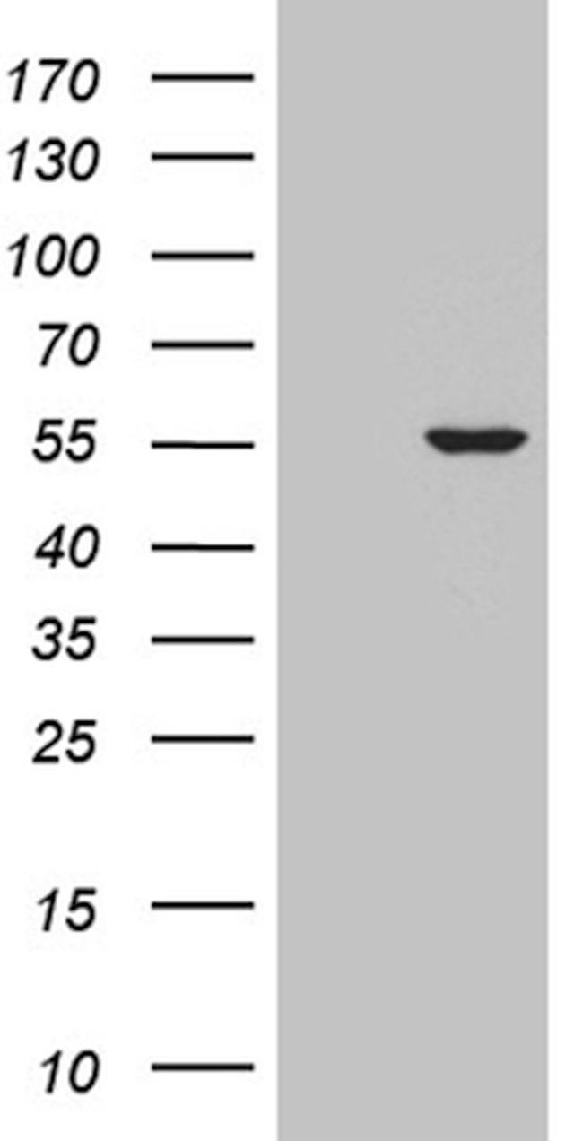 CELF6 Antibody in Western Blot (WB)