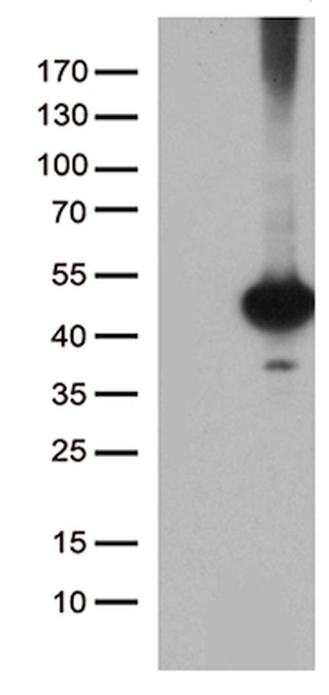 CELF6 Antibody in Western Blot (WB)