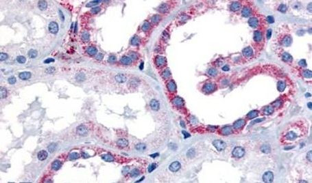 CELSR1 Antibody in Immunohistochemistry (Paraffin) (IHC (P))