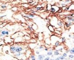 APOBEC3G Antibody in Immunohistochemistry (IHC)