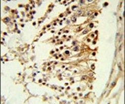CENPH Antibody in Immunohistochemistry (IHC)