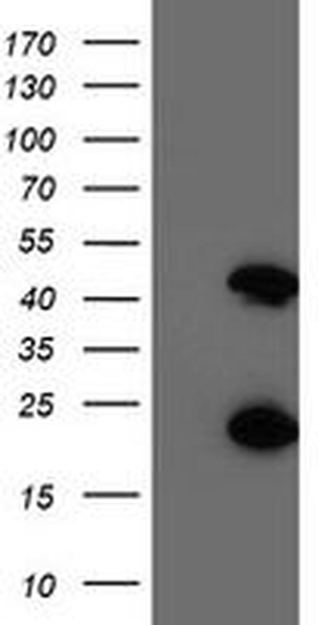 CENPH Antibody in Western Blot (WB)