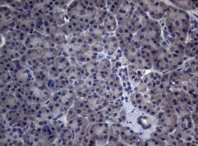 CEP55 Antibody in Immunohistochemistry (Paraffin) (IHC (P))