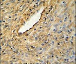 CEP63 Antibody in Immunohistochemistry (IHC)
