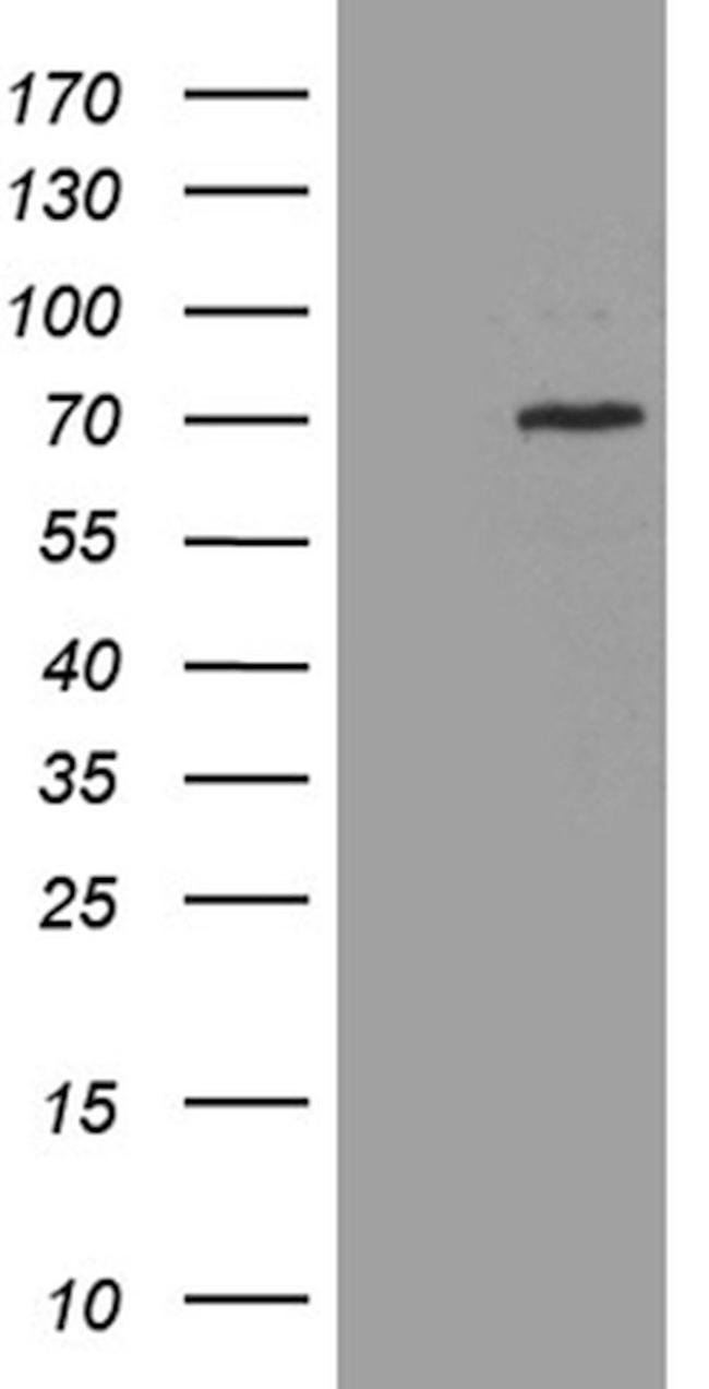 CEP72 Antibody in Western Blot (WB)