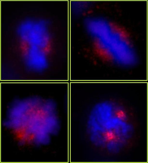 CEP78 Antibody in Immunocytochemistry (ICC/IF)