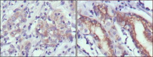 CER1 Antibody in Immunohistochemistry (Paraffin) (IHC (P))