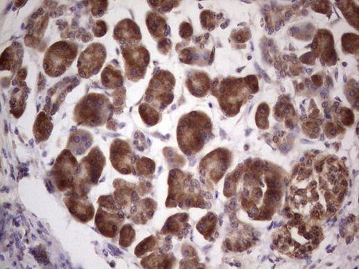 CETN1 Antibody in Immunohistochemistry (Paraffin) (IHC (P))