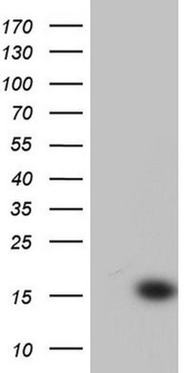 CETN1 Antibody in Western Blot (WB)