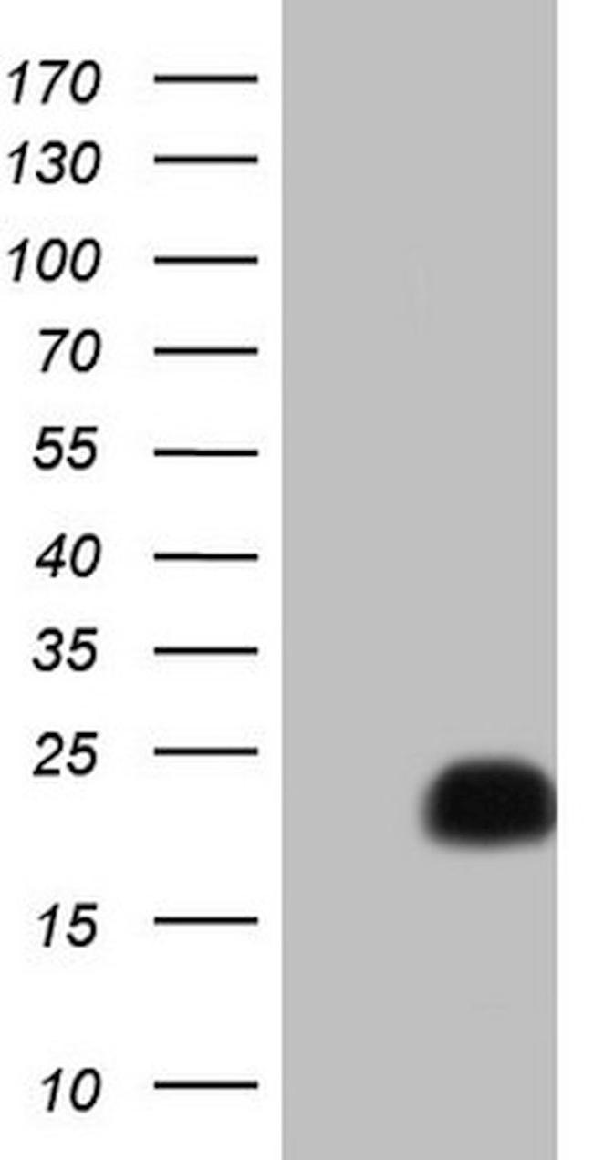 CETN1 Antibody in Western Blot (WB)