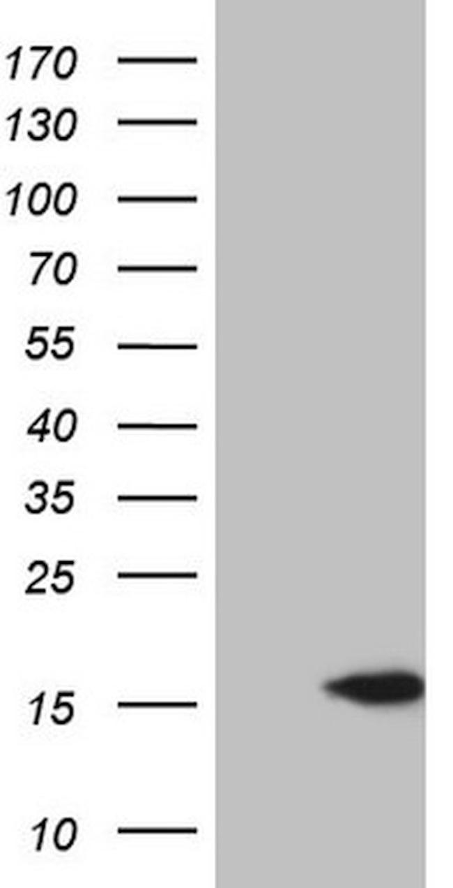 CETN3 Antibody in Western Blot (WB)