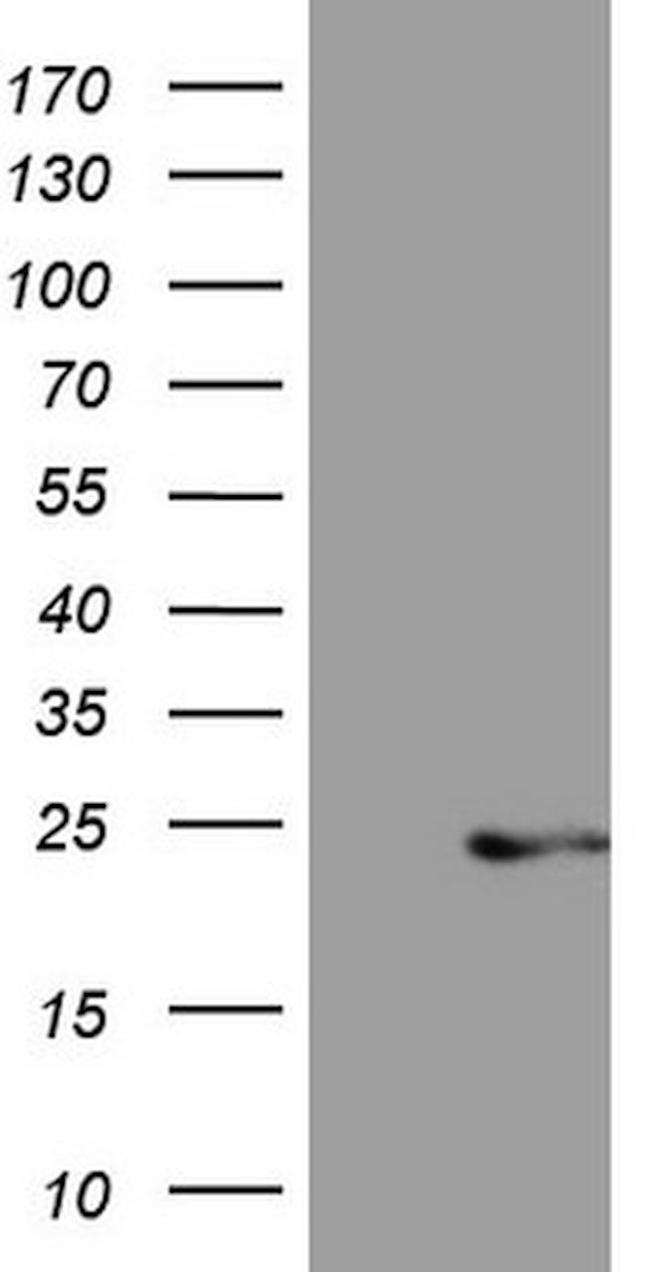 CETN3 Antibody in Western Blot (WB)