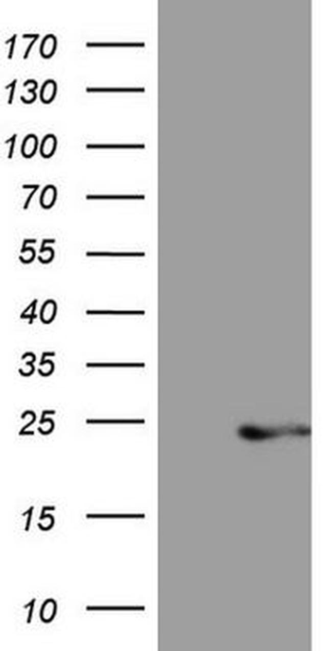 CETN3 Antibody in Western Blot (WB)