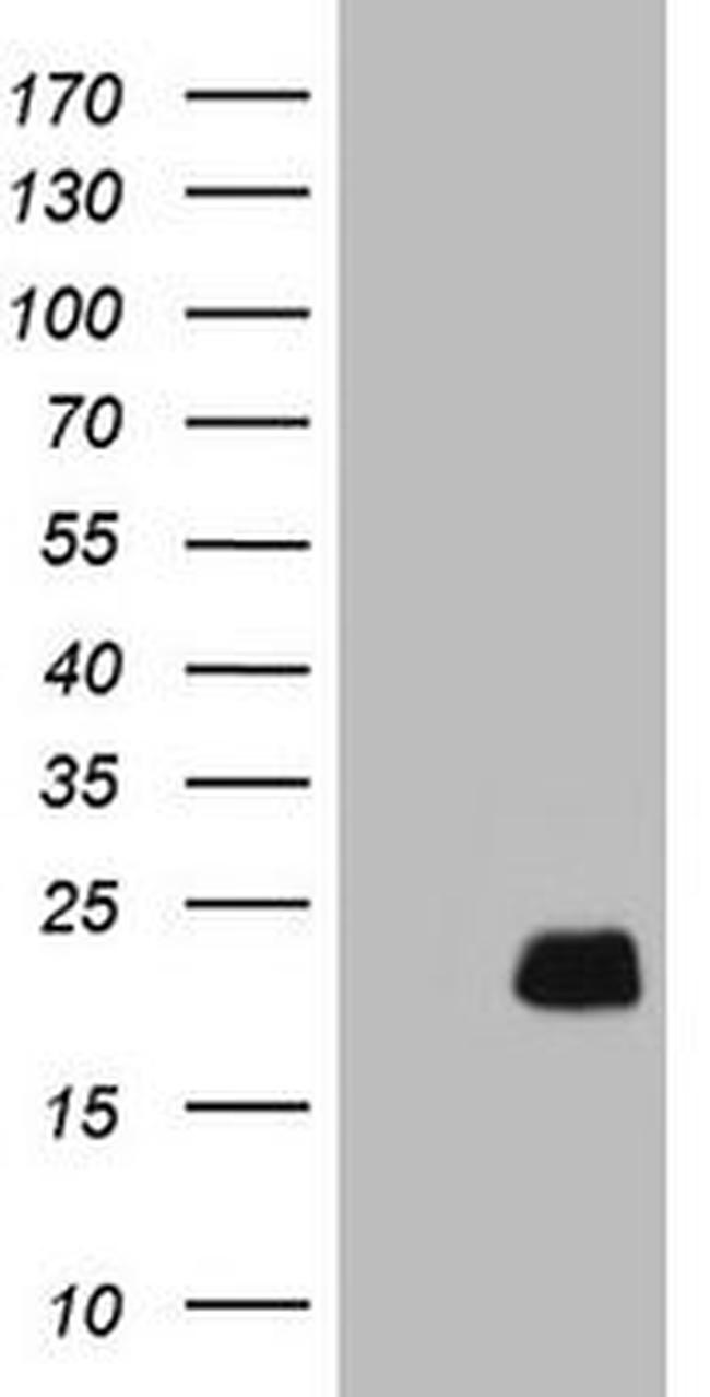 CETN3 Antibody in Western Blot (WB)