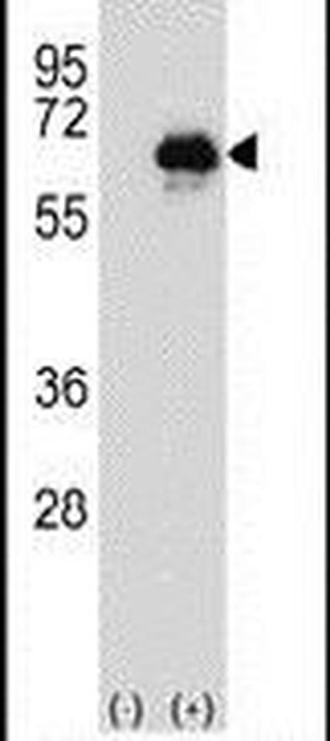 CETP Antibody in Western Blot (WB)
