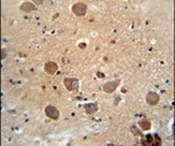 C6orf62 Antibody in Immunohistochemistry (IHC)