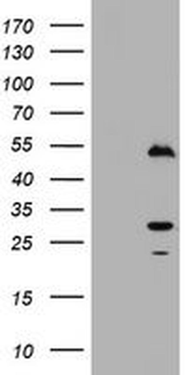 Timer Antibody in Western Blot (WB)