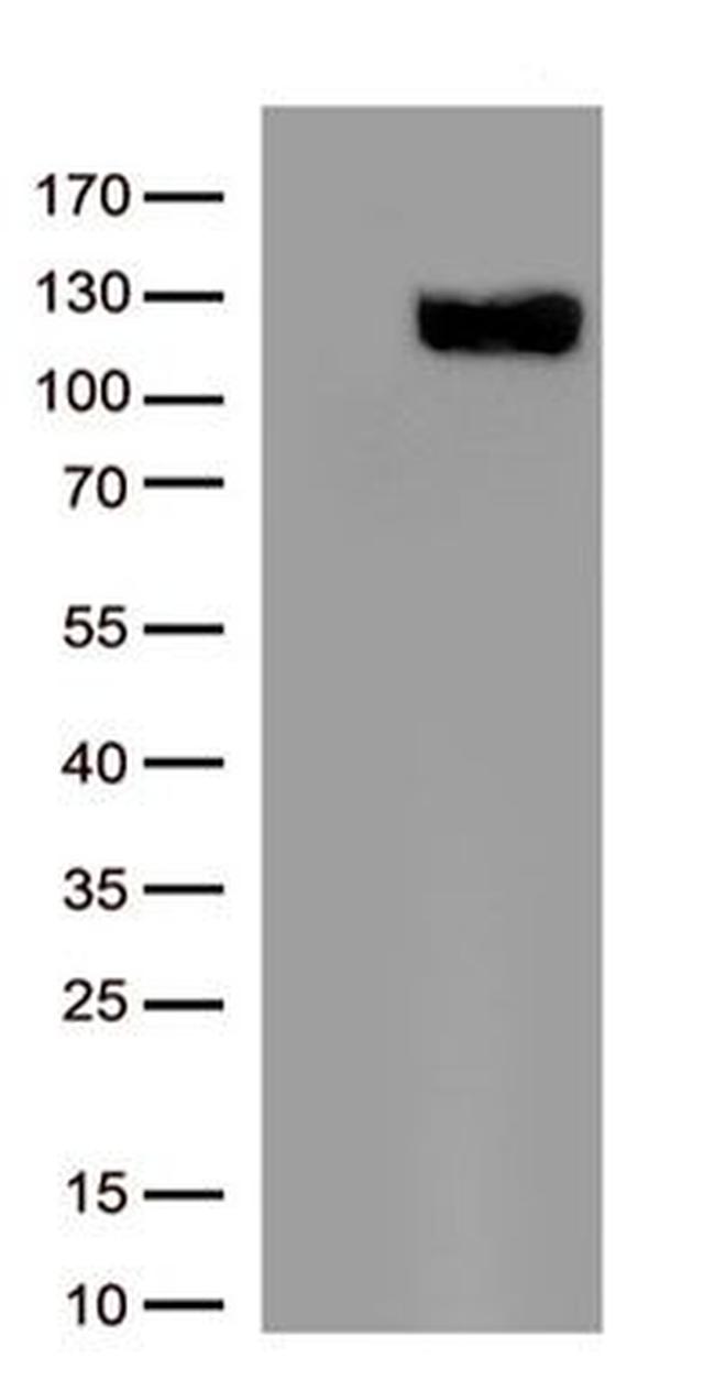 ACE2 Antibody in Western Blot (WB)