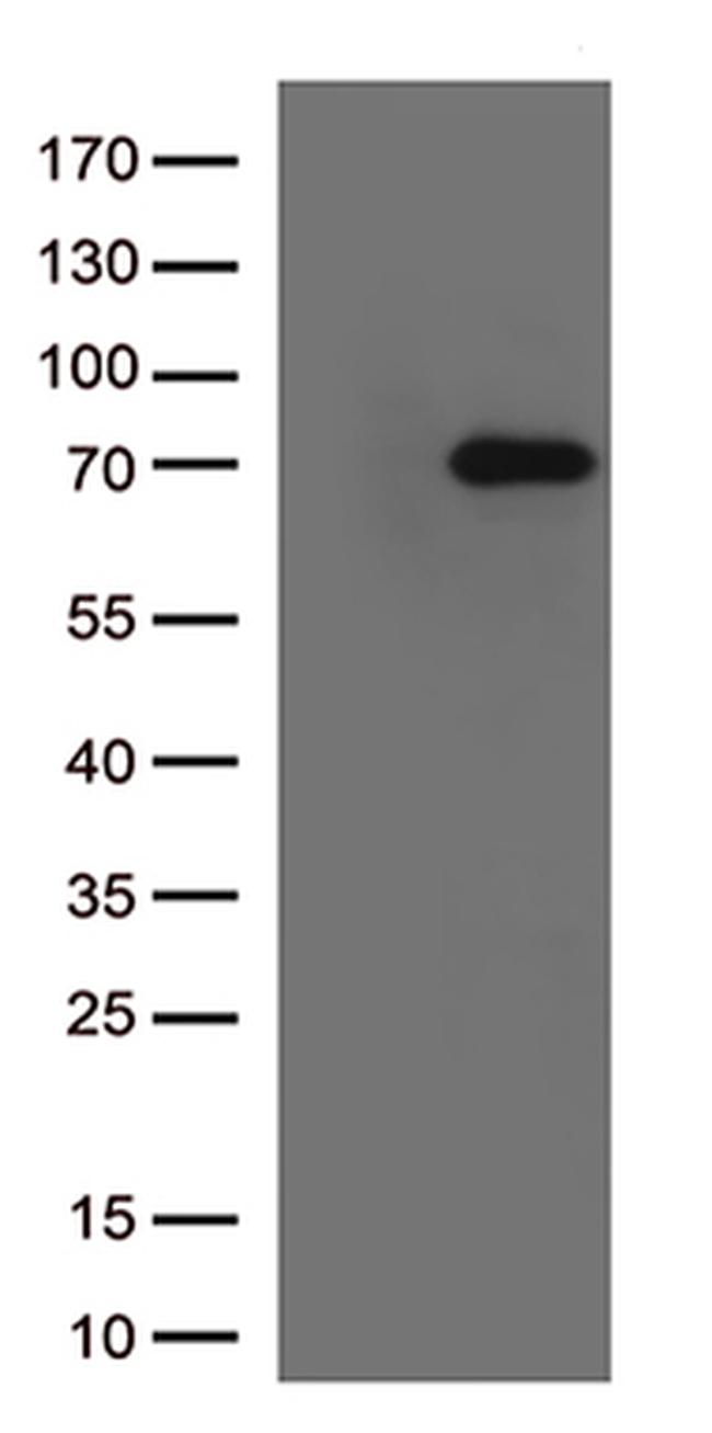 Lymphocyte Activation Gene 3 (LAG3) Antibody in Western Blot (WB)