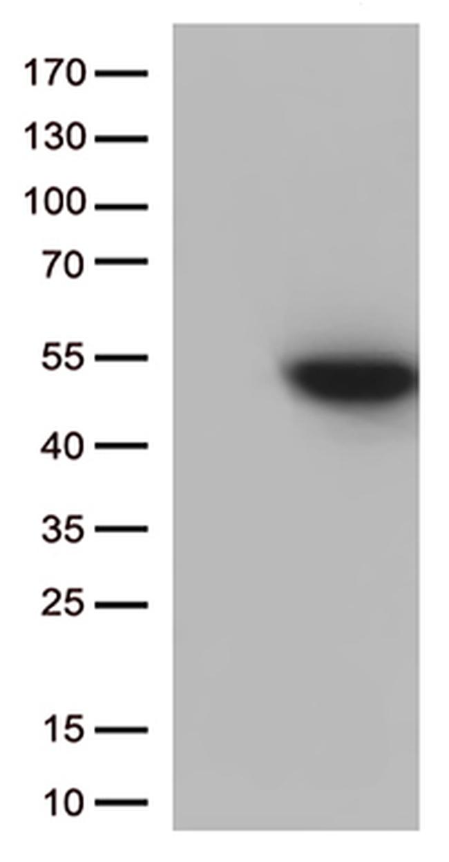 CDK15 Antibody in Western Blot (WB)