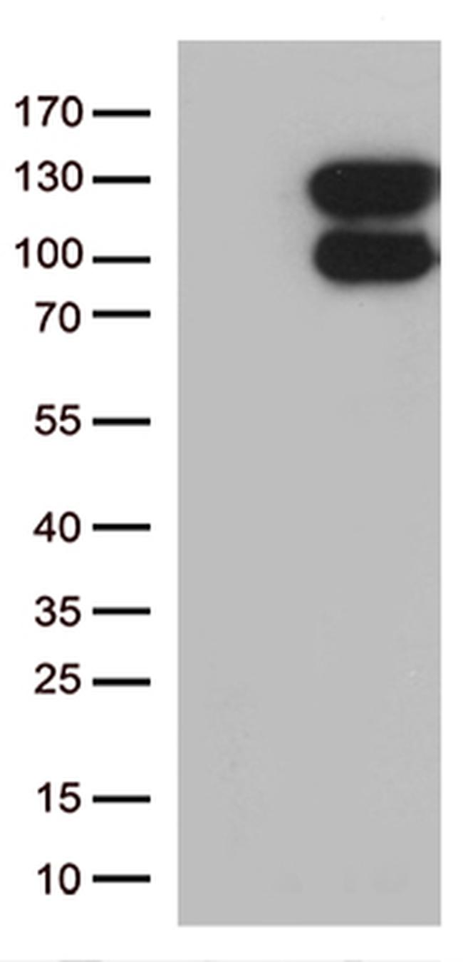 VPS50 Antibody in Western Blot (WB)
